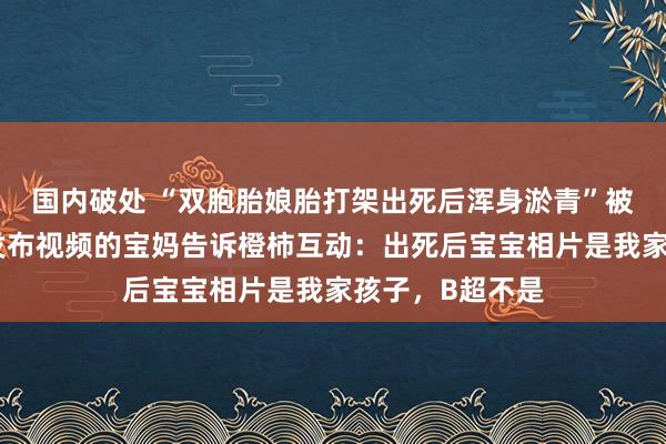 国内破处 “双胞胎娘胎打架出死后浑身淤青”被质疑着实性！发布视频的宝妈告诉橙柿互动：出死后宝宝相片是我家孩子，B超不是